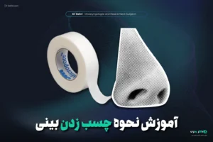 آموزش نحوه چسب زدن بینی-دکتر مریم بحری - 3