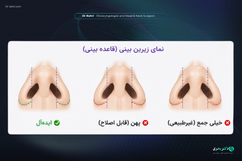 Nasal Alae - dr bahri 2