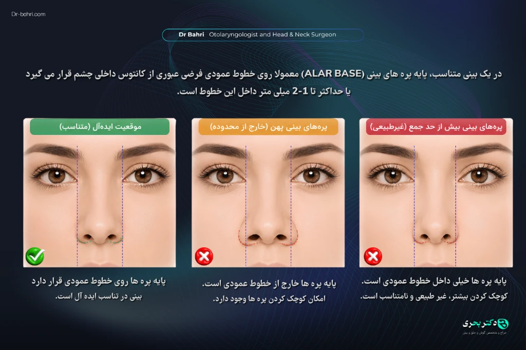 Nasal Alae - dr bahri